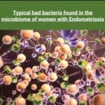 microbiome of women with endometriosis