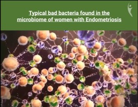 microbiome of women with endometriosis